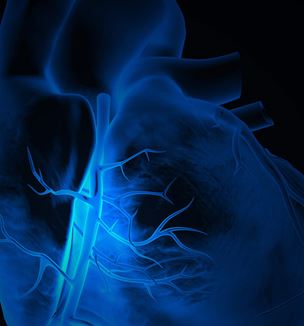 Getty image of coronary artery of heart