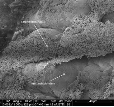 Scanning electron microscopy (SEM) image of a large biofilm plaque consisting of Candida and bacteria adhering to the intestinal epithelium.